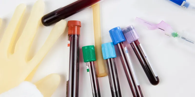 blood test 2